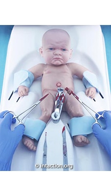circumcision pain trauma baby infant ric vmmc