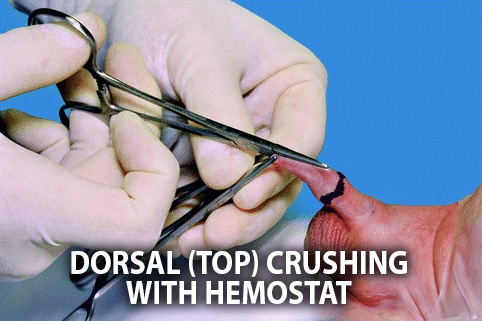 circumcision foreskin hemostat crush dorsal cut