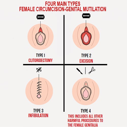 circumcision FGM female mutilation